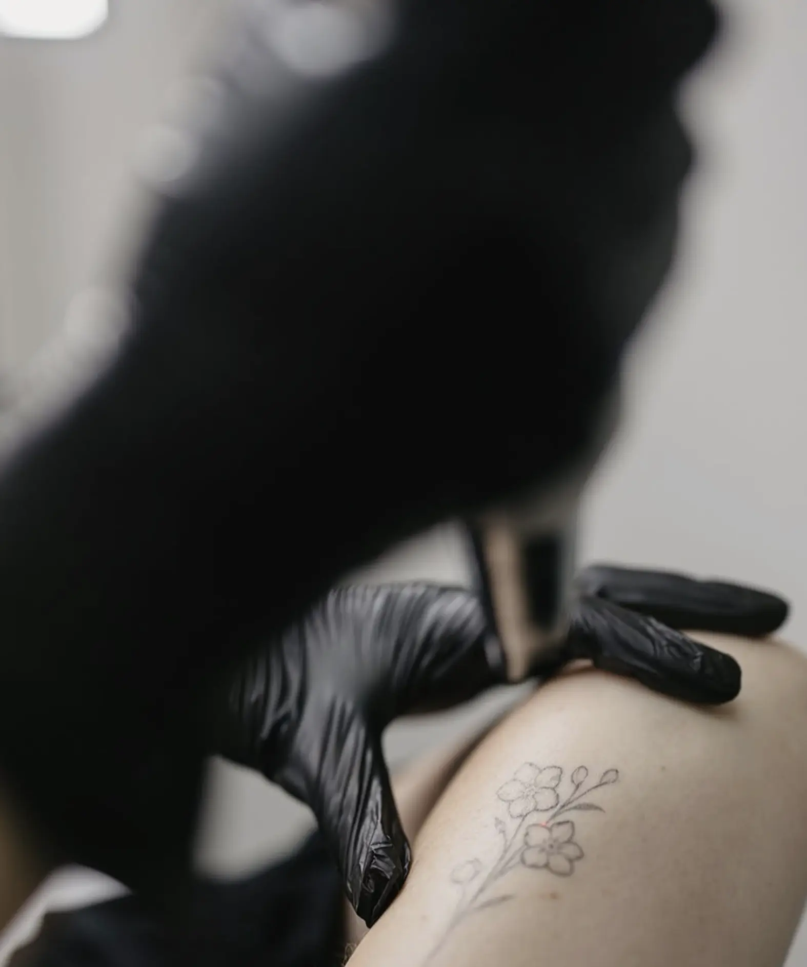 Laser Tattoo Removal Healing