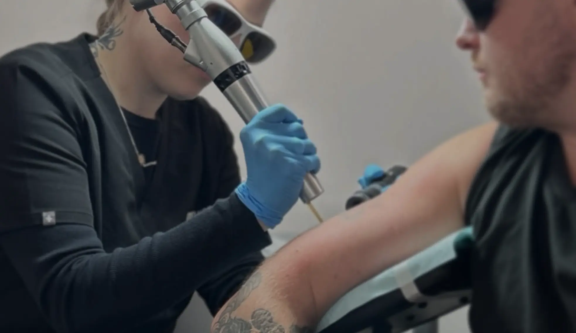 Laser Tattoo Removal