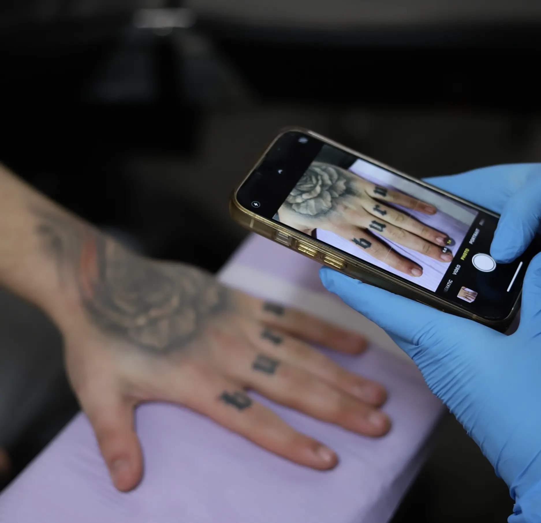 Tattoo Removal Brisbane