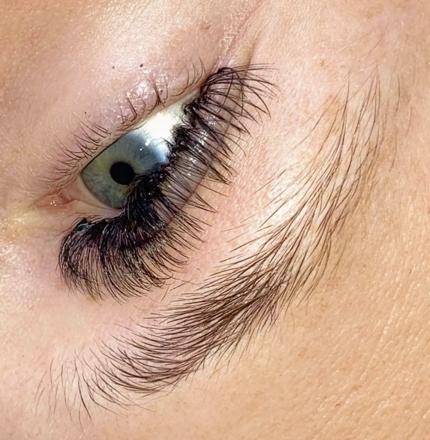 is brow lamination safe for eczema